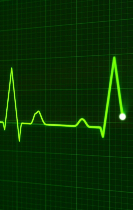 Green heartbeat pulse line on a monitor display.